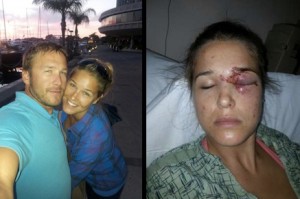 Bode Miller: Tragischer Unfall auf dem Golfplatz